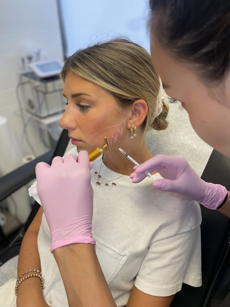 versa-dermal-filler-temple